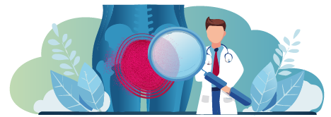 Bild zeigt Geschlechtskrankheiten ausschließen (STI-Test)